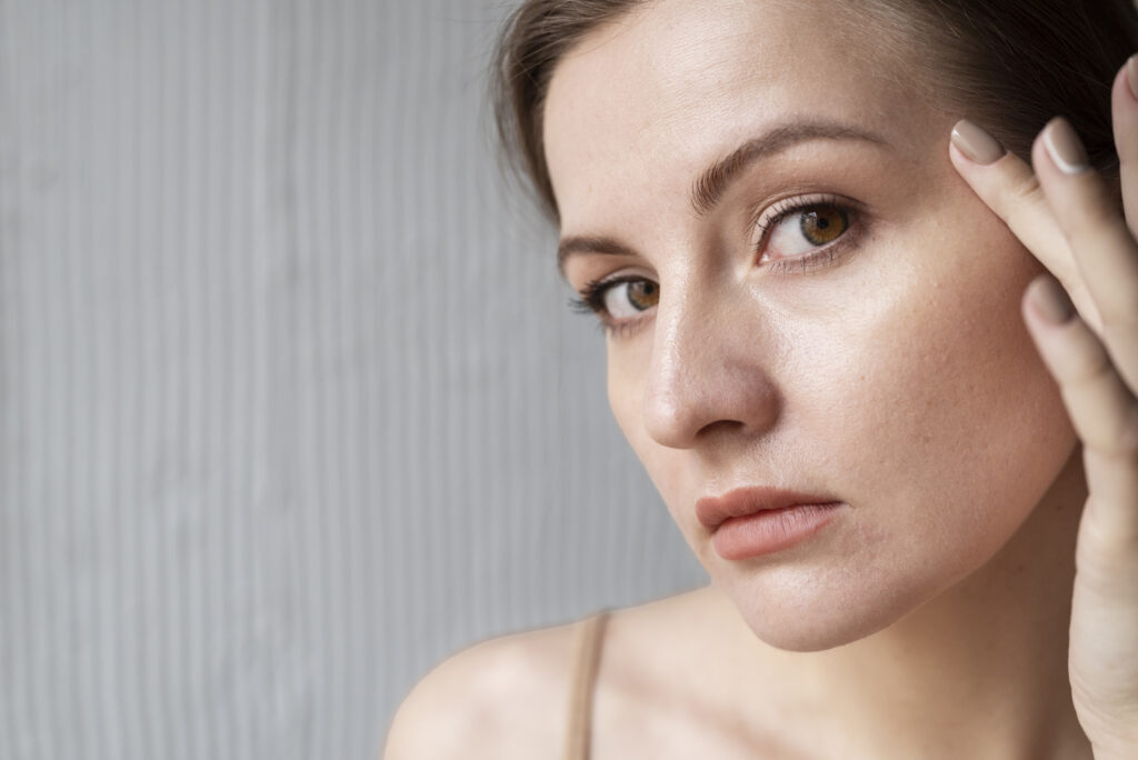 Woman with dry skin following a skincare routine for dry skin